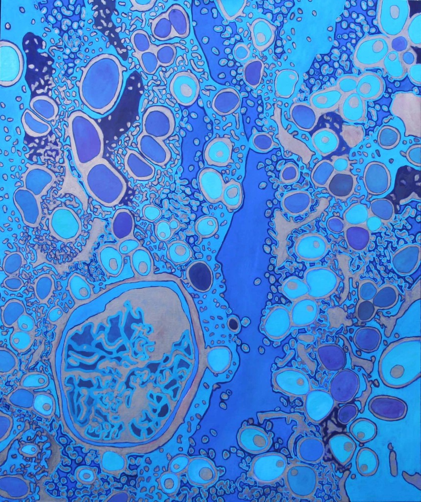 Diabetes	, oil on canvas, 50” x 60”