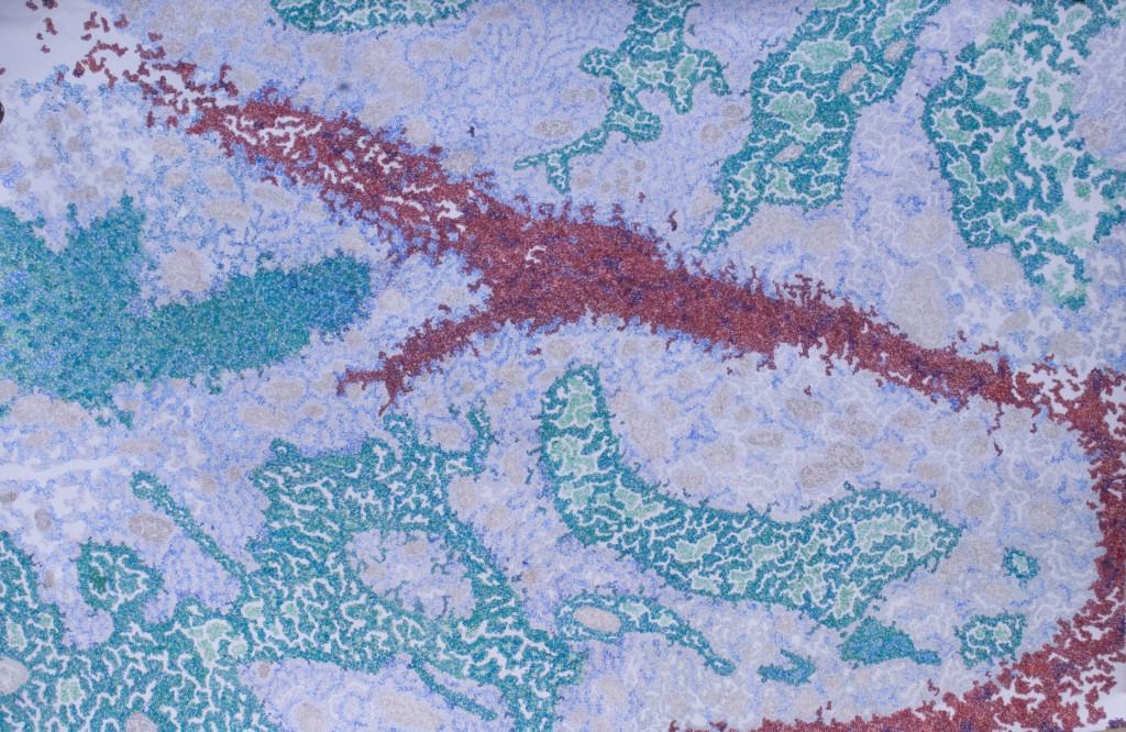 Ovarian Cancer, colored pencil on paper, 81” x 55”